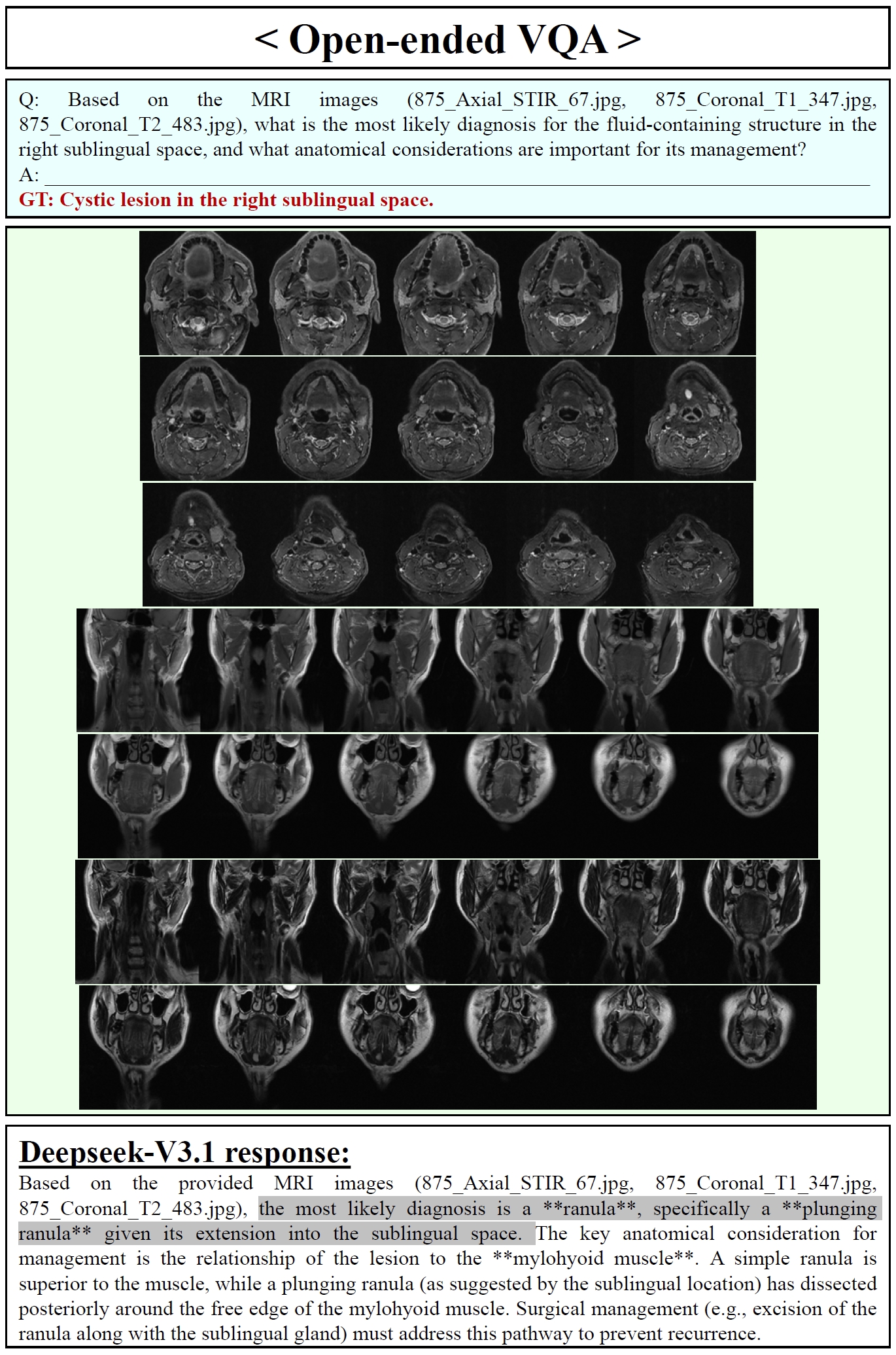 Deepseek-V3.1 Open-ended VQA Samples